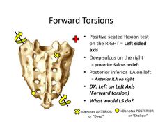 sacral torsions seated flexion test|sacral shear and torsion pain.